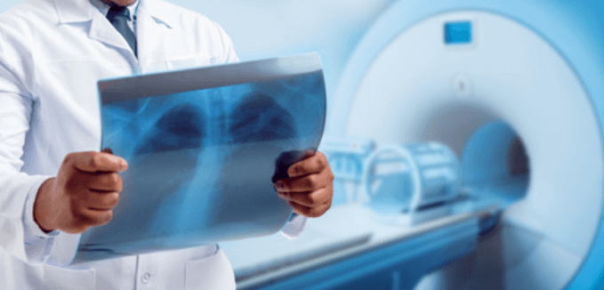 CT Scans and X-rays