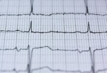 elevate prism pulse online